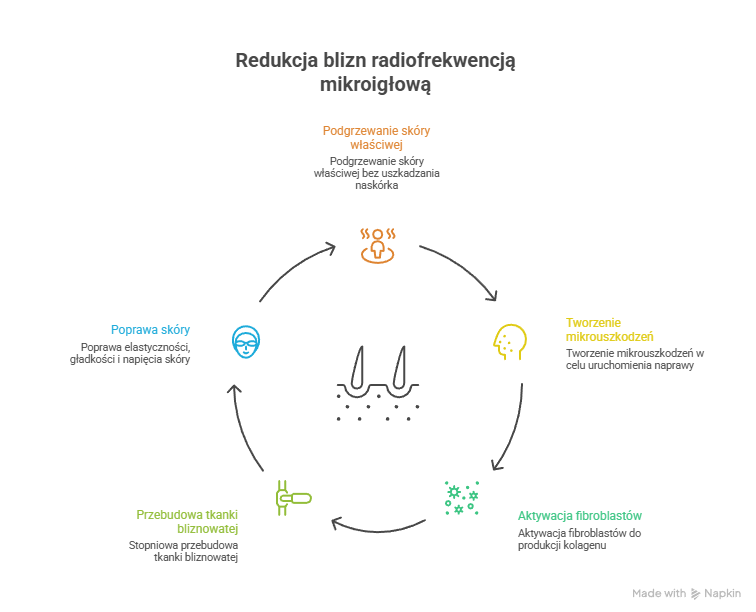 Jak działa radiofrekwencja mikroigłowa na usuwanie blizn